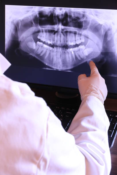 Best Emergency Root Canal Treatment in White Horse, NJ