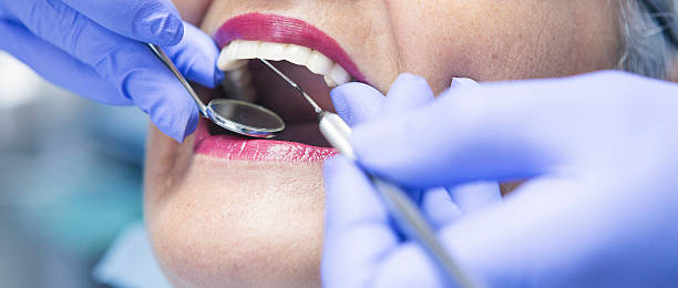 Best Emergency Dental Surgery in White Horse, NJ