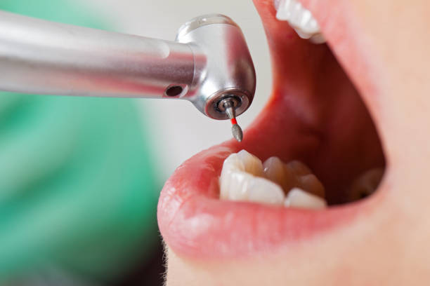 Best Emergency Broken Tooth Repair in White Horse, NJ